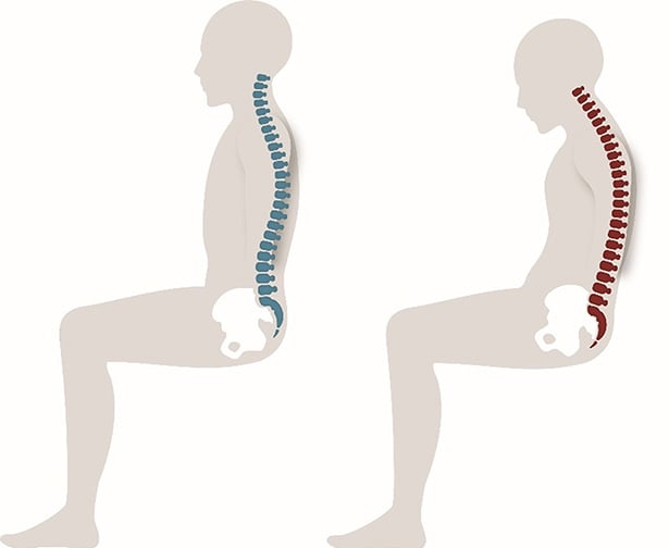 bad-posture
