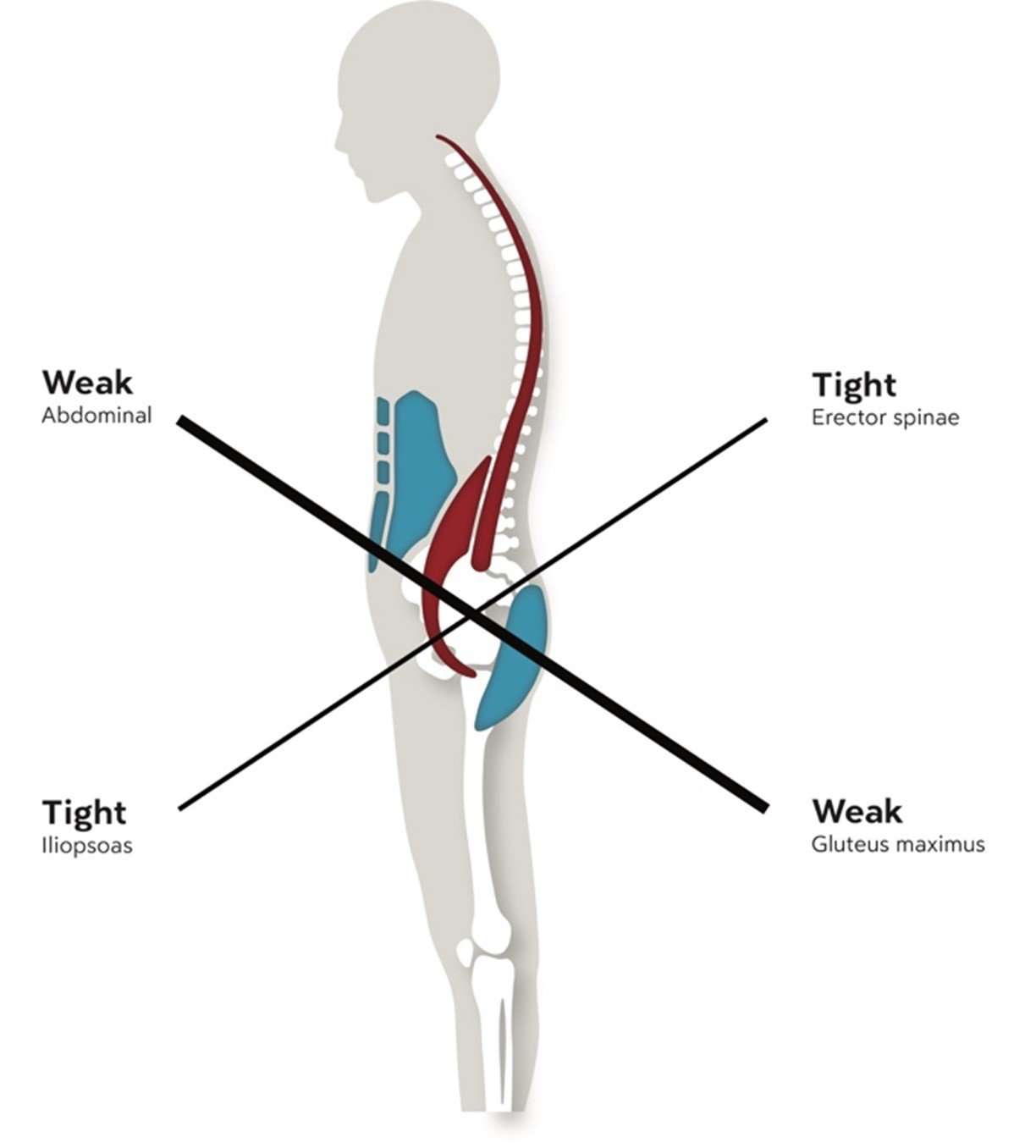 tight-weak-full-img