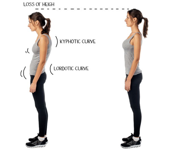 two-girls-posture